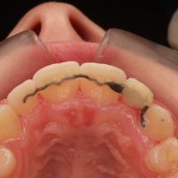 Home retainer digitali (3)