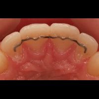 Home retainer digitali (5)