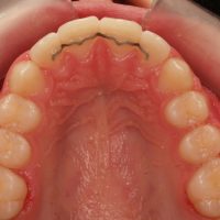 Home olympus digital camera